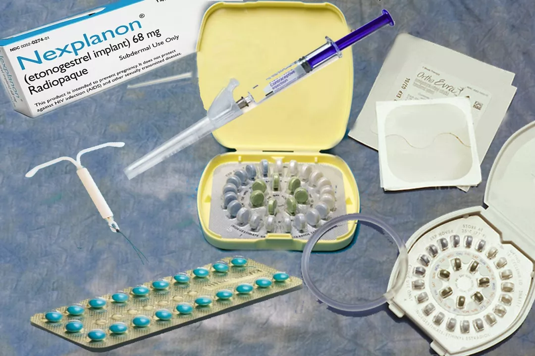 The Role of Contraception in Managing Polycystic Ovary Syndrome (PCOS)